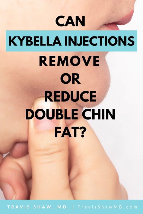 Kybella Before And After Double Chin, Kybella Before And After, Chin Sculpting, Double Chin Removal, Double Chin Exercises, Botox Before And After, Reduce Double Chin, Chin Exercises, Erasable Markers