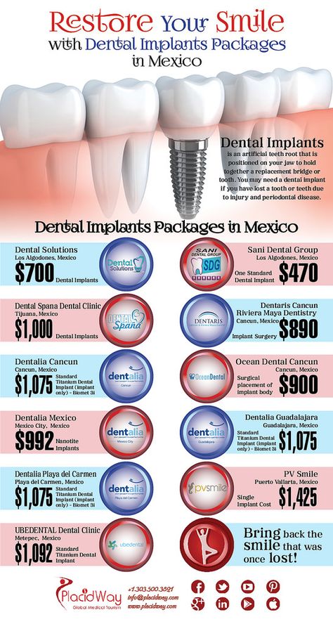 Dental Implants Before And After, Braces Types, Free Dental Implants, General Physician, Health Notes, Dental Education, Affordable Dental Implants, Dental Implant Procedure, Sensitive Teeth Remedy