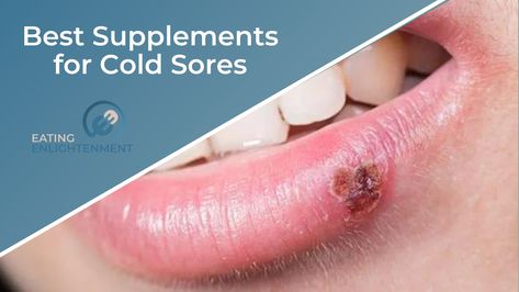 If you are one of the millions of people who suffer from cold sores, you know how painful and embarrassing they can be. There are a number of supplements that have been shown to help reduce the symptoms and duration of a cold sore outbreak. In this blog post, we will discuss 5 of the […] The post 5 Best Supplements for Cold Sores appeared first on Eating Enlightenment. Lysine For Cold Sores, Cold Sore Prevention, Vitamin B Deficiency, Zinc Supplements, Mineral Deficiency, Cold Sores, Cold Sore, Juicy Lips, Now Foods