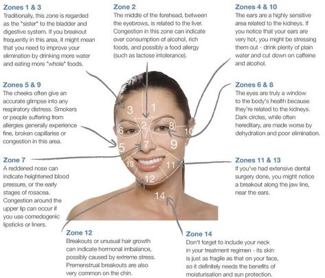 Face Mapping: Can You Use It to Improve Your Skin's Health? Doterra Acne, Gesicht Mapping, Face Map, Face Mapping Acne, Face Mapping, Acne Causes, Cosmetics Ingredients, Face Acne, Beauty Stuff