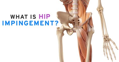 Hip Impingement Exercises, Hip Impingement, Pelvic Floor Muscle Exercise, Bursitis Hip, Core Exercise, Hip Surgery, Water Birth, Muscle Imbalance, Pelvic Floor Exercises