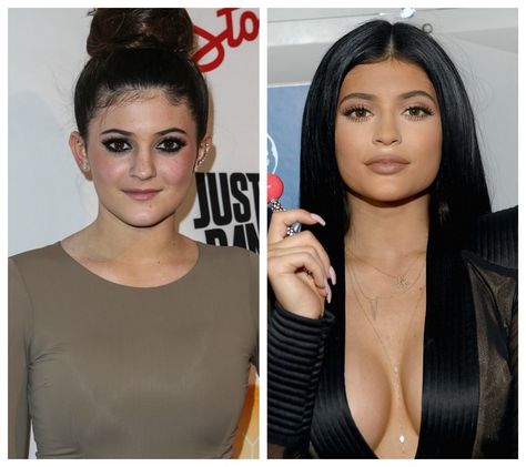 Biggest transformation in Hollywood ever Kylie Jenner Sister, Kylie Jenner Plastic Surgery, Plastic Surgery Photos, Look Kylie Jenner, Kyle Jenner, Rocket Scientist, Kylie J, Celebrity Plastic Surgery, Celebrities Before And After