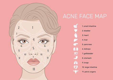 Acne Map and Your Health Doterra Acne, Gesicht Mapping, Acne Face Map, Face Map, Face Mapping Acne, Pimples On Face, Face Mapping, Acne Face Wash, Natural Acne Remedies