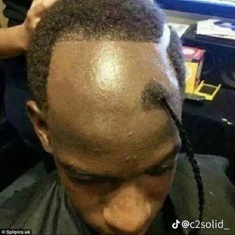 Hairstyles For Bad Hairline, Ugly Hair Cuts, Worst Haircut Ever, What Haircut Should I Get, Bad Hairline, Haircut Fails, Ugly Hair, Hair Fails, Waves Haircut