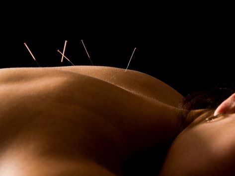 Acupuncture Aesthetic, 2024 Moodboard, Life Force Energy, Integrative Medicine, Ayurvedic Medicine, Deep Tissue, Traditional Chinese Medicine, Healing Process, Chinese Medicine