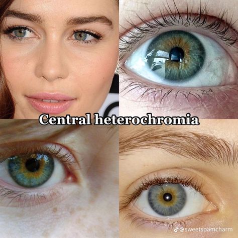 Central Heterochromia, Pretty Eyes Color, Heterochromia Eyes, Eye Color Chart, Rare Eyes, Beautiful Eyes Color, Gray Eyes, Aesthetic Eyes, Gorgeous Eyes