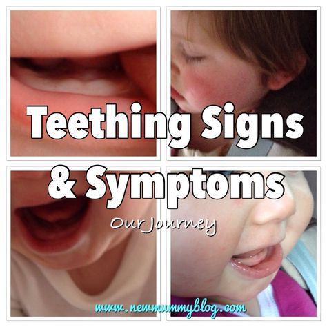 Teething signs and symptoms - New Mummy Blog Teething Signs, Teething Symptoms, Red Cheeks, Signs And Symptoms, First Tooth, Baby Teeth, Parenting, Signs