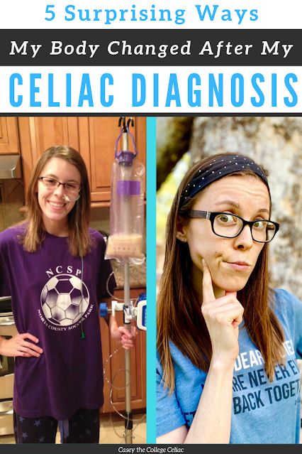 More changes with a #celiacdisease diagnosis than going #glutenfree. #Celiac can also change your body in some surprising ways! #chronicillness #gf Celiacs Disease, Celiac Diagnosis, Celiac Diet, High Fodmap Foods, Blood Type Diet, Sjogrens Syndrome, Stomach Problems, Gluten Sensitivity, Gluten Intolerance