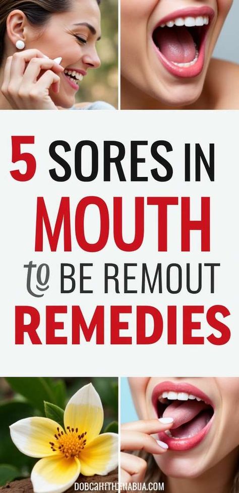 Say goodbye to painful mouth sores! Discover effective remedies that bring quick relief and promote healing. From natural treatments to soothing gels, weve got you covered! Click to explore tips that will help you eat, speak, and smile comfortably again.  #MouthSores #HealthTips #NaturalRemedies Sores In Mouth, Sore In Mouth Remedies, Natural Treatments, Natural Remedies, Health Tips, Healing, Bring It On, Health