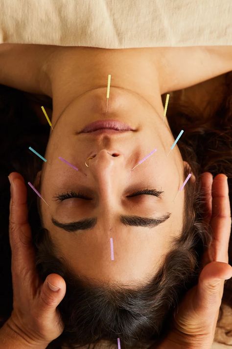 Cosmetic Acupuncture, Facial Cupping, Natural Beauty Treatments, Facial Rejuvenation, Acupuncture Points, Popsugar Beauty, Homemade Face Masks, Homemade Face, Cosmetic Procedures