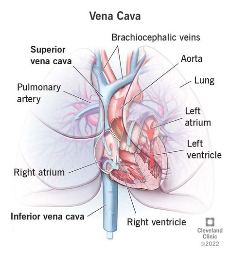 Vena Cava: Function and Anatomy Superior Vena Cava, Central Venous Catheter, Nerve Fiber, Swollen Legs, Heart Rhythms, Magnetic Resonance Imaging, Magnetic Resonance, Cleveland Clinic, Leg Pain