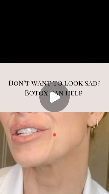 Jill Campbell - Houston Nurse Practitioner on Instagram: "◾️Don’t want to look sad? 4 units of botox can help - here is how…  ◾️The DAO muscle pulls the corners of the mouth down.  ◾️Adding 2 units of botox to each side lessens the downward pull allowing the corners of the mouth to turn upward.   ◾️PROTIP- treating the chin with botox keeps the mentalis muscle from swinging up which can further minimize the appearance of the frown muscles pulling down.   🛟 Save this post for your reference.  👩🏼‍⚕️ Jill Campbell , FNP-C, CANS 📍 The Woodlands, TX 💻 @aestheticsjill • 🏥 Dr.Guy Facial Plastic Surgery ☎️ (832) 956-1040  💻  @drguyfacialplastics • 🏥 Avante Laser & Medical Spa ☎️ (281) 419-0080 💻 @avantemedispa  #filler #botox #houston_insta #houstoninjections #houstonfiller #thewoodlandst Dao Botox Before After, Botox Around Mouth, Californian Hair, Botox Injection Sites, Botox Facial, Liquid Facelift, Botox Before And After, Botox Lips, Botox Face