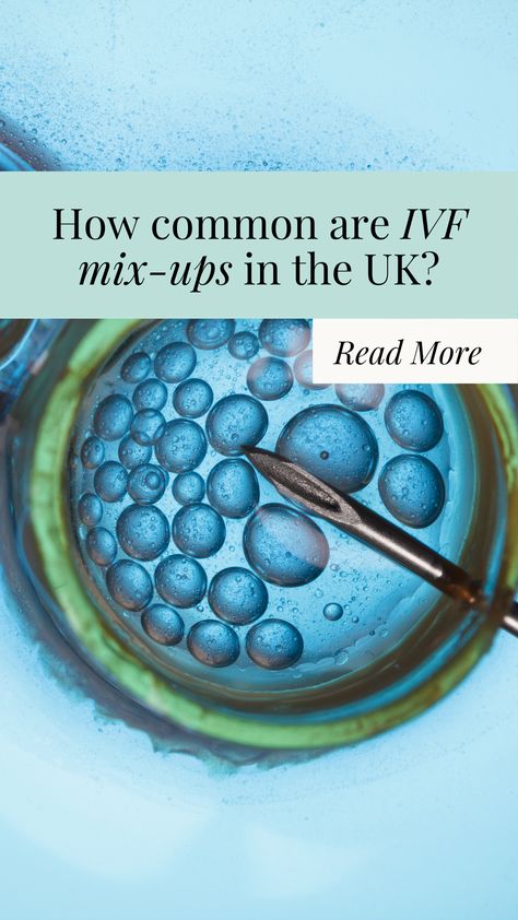 In short, extremely rare. Your clinic should be able to run you through these rigorous checking requirements, any time you ask. But recent headlines covering a heartbreaking embryo implantation error in California, USA, have triggered understandable renewed concerns. So, how common are IVF mix-ups UK-wise, in 2024? Let’s dig in. Embryo Implantation, California Usa, Fertility, About Uk, The Uk, Ups, California