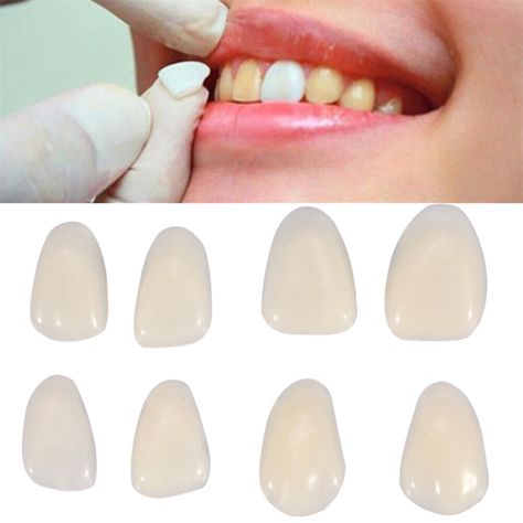 Dental Oral Front Anterior Teeth Film Molar Temporary Patch Veneer Dental Repair | eBay Teeth Veneers, Temporary Crown, Tooth Crown, Teeth Covers, Temporary Tooth, Tooth Repair, Veneers Teeth, Loose Tooth, Crown For Kids