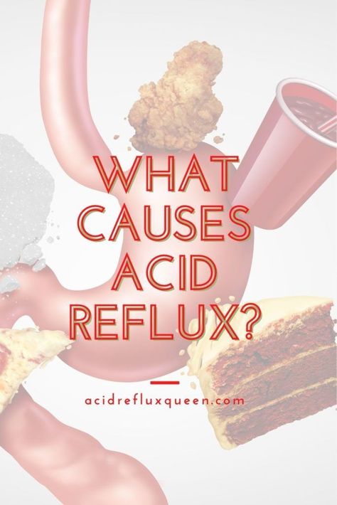 Dealing with chronic acid reflux for GERD and not sure why? Here's the common causes of acid reflux and how you can treat it naturally. Get rid of acid reflux. Natural remedies for acid reflux. GERD treatments. How to get rid of heartburn. Prevent heartburn and acid reflux. #acidreflux #heartburn #gerd Acid Reflux Foods, What Causes Acid Reflux, Acid Reflux Relief, Reflux Disease, Inflammatory Foods, Stomach Acid, Body Healing, Acid Reflux, Digestion Problems