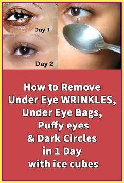 One Simple Ingredient To Get Rid Of Droopy Eyelids Forever Eye Wrinkles Remedies, Puffy Eyes Remedy, Home Remedies For Wrinkles, Cucumber On Eyes, Droopy Eyelids, Eye Wrinkles, Wrinkle Remedies, Wrinkle Free Skin, Styles Braids