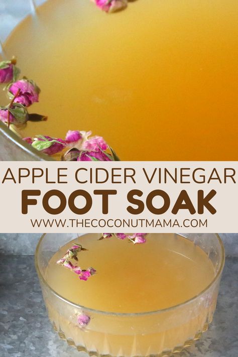 This apple cider vinegar foot soak is great for removing dead skin cells from the feet and may help with smelly feet and foot fungus. Foot Fungus Soak, Vinegar Foot Soak, Apple Cider Vinegar Foot Soak, Fungi Recipe, Foot Detox Soak, Diy Foot Soak, Foot Soak Recipe, Whipped Coconut Oil, Homemade Body Butter