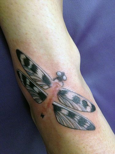 Acl Scar Tattoo Cover Up, Butterfly Scar Tattoo, Zipper Tattoo Over Scar, Ankle Surgery Scar Tattoo, Ankle Scar Tattoo Cover Up, Ankle Scar Tattoo, Surgical Scar Tattoo, Foot Butterfly Tattoo, Tattoos On Scars