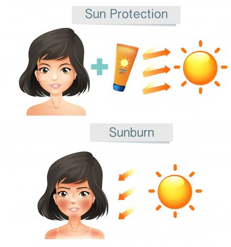 Vector showing women skin after sun | Free Vector #Freepik #freevector #background #travel #icon #summer Beauty Treatments Spa, Sunscreen Facts, Face Care Acne, Beauty Skin Quotes, Forehead Acne, Skin Care Pictures, Face Care Routine, Skin Photo, Natural Beauty Diy