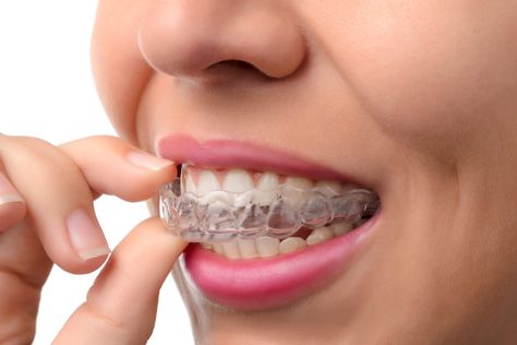 Dental Bridge Cost, Smile Book, Braces Cost, Dental Surgery Food, Invisalign Aligners, Teeth Alignment, Hollywood Smile, Dental Posters, Traditional Braces