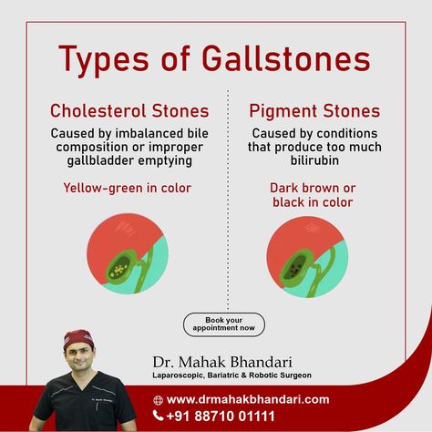 Gallbladder Stone Basics: Get to Know the Two Types 1️⃣ Cholesterol Stones: These are the most common, sporting a yellow-green hue. They form when there's too much bile in the gallbladder. 2️⃣ Pigment Stones: Smaller and darker, these stones are crafted from bilirubin, a component of liver-produced bile, stored in the gallbladder. Understanding gallstones helps you take charge of your health! #GallbladderStones #HealthEducation #ListenToYourBody #HealthAwareness #Gallstones #BiliaryHealth Gallbladder Stones, Laparoscopic Surgery, Take Charge, Pharmacology, Air Compressor, Health Awareness, Health Education, Our Body, Type 1