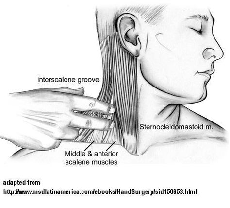 Punkty Spustowe, Thoracic Outlet, Forward Head Posture Exercises, Neck And Shoulder Exercises, Neck And Shoulder Muscles, Posture Exercises, Spine Surgery, Neck Pain Relief, Neck And Shoulder Pain