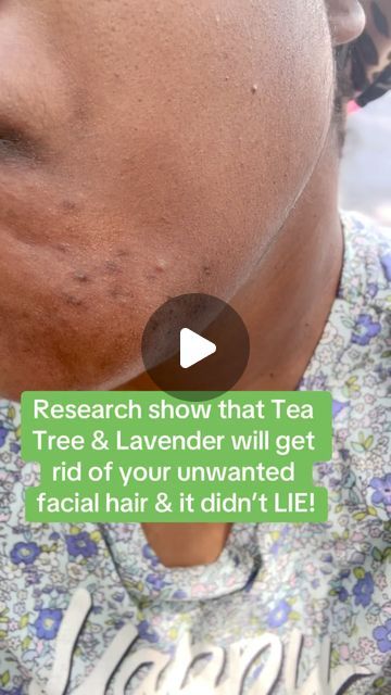 Unwanted Hair Growth, Yeast Infections, Beauty Hacks Skincare, More Confidence, The Whispers, Unwanted Facial Hair, Wrinkle Reduction, Facial Exercises, Feeling Trapped