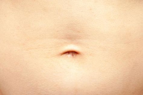 My Belly Button Smells - All Possible Reasons #bellybutton #health  #healthylifestyle Infected Belly Button, Belly Button Healing, Belly Button Cleaning, Belly Button Smell, Odor Remedies, Kids Fever, Skin Moles, Heat Rash, Extra Skin