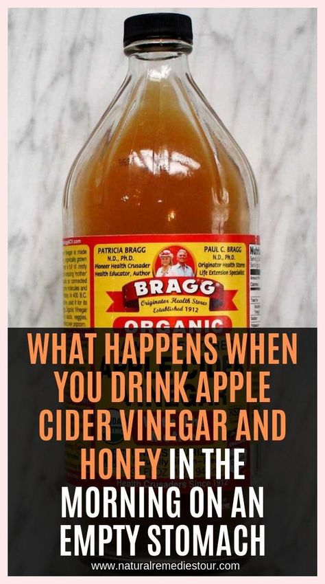 Inestimable content! Apple Cider Vinegar And Honey, Medical Remedies, Hollistic Health, Truvision Health, Organic Drinks, Diet Changes, Unfiltered Apple Cider Vinegar, Silent Killer, Health Tonic