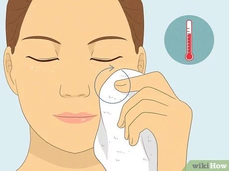 How to Remove Under Eye Milia: 3 Safe & Effective Methods Eye Pimple How To Get Rid, How To Remove Milia Under Eyes, Remove Milia On Face, How To Remove Milia From Face, How To Get Rid Of Milia Under Eyes, How To Get Rid Of Milia On Face, Milia Removal Diy, Milia Removal Remedies, Millia Removal