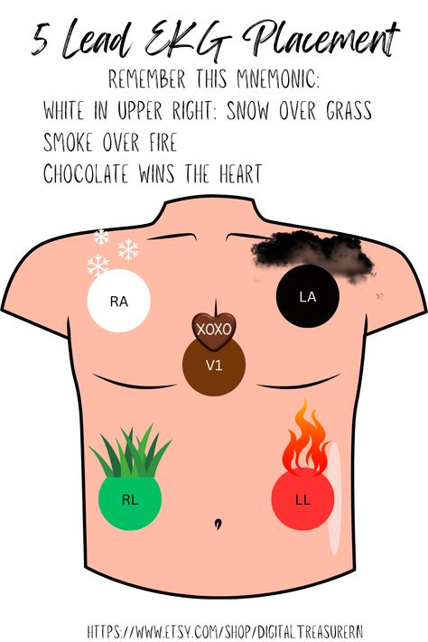 Ekg Leads Placement, Ekg Lead Placement, 12 Lead Ekg Placement, Ekg Placement, Lead Placement, Ekg Leads, Telemetry Nursing, Emt Study, Nurse Study