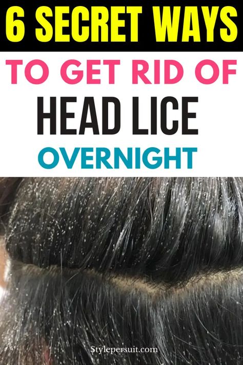 Lice Hair Removal, Lice Remedies How To Get Rid Of Home, Lice Removal Home Remedies, Lice Eggs Removal, Hair Lice Remedies How To Get Rid, How To Get Rid Of Nits In Hair, How To Get Rid Of Lice, Lice Remedies How To Get Rid Of, How To Get Rid Of Lice Fast