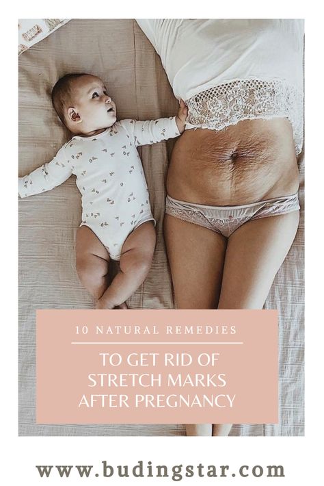 Pregnancy Workout Videos, Mommy Pooch, Strech Marks, Post Pregnancy Body, Stretch Mark Remedies, Muffins Breakfast, Post Pregnancy Workout, Diy Crib, Image Couple