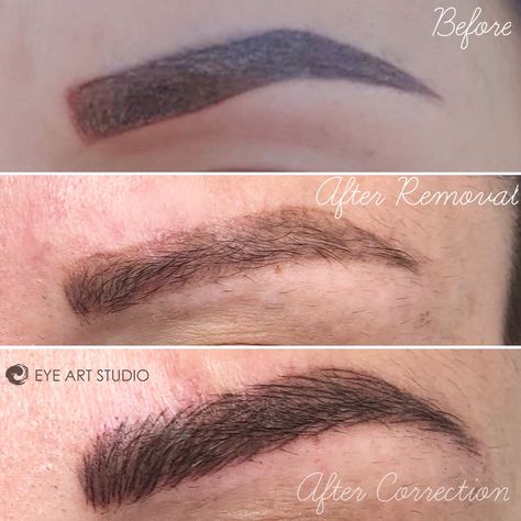 Eyebrow Microblading tattoo removal and correction repair - Eye Art Studio Laser Tattoo Removal Healing, Tattoo Correction, Faded Eyebrows, Eyebrow Feathering, Eyebrow Tattoo Removal, Tattoos Gone Wrong, Eyebrows Tattoo, 9 Tattoo, Eyebrow Microblading