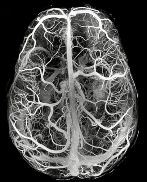 Neuroscience Art, Brain Art, Magnetic Resonance, How To Gain, Glitch Art, Human Brain, Ap Art, Anatomy And Physiology, Neurology