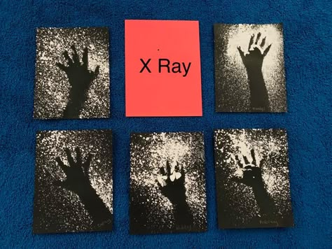 Nurses Preschool Activities, Doctor Eyfs Activities, Doctors And Nurses Eyfs Activities, Doctors Eyfs, Doctors Eyfs Activities, Nurse Crafts For Preschool, X Ray Dramatic Play, X Ray Craft, Reggio Doctor Activities