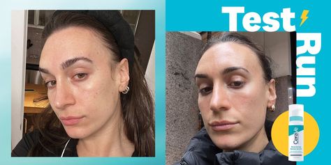 Don't Believe In The Power Of Retinol? My Before And After Photos Will Shock You Retinol Before And After, Fade Acne Marks, Skin Transformation, My Skincare Routine, Freelance Makeup Artist, Clean Cosmetics, Face Masks For Kids, Oil Free Moisturizers, Skin Imperfection