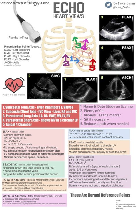 Cath Lab Nursing, Diagnostic Medical Sonography Student, Ultrasound School, Cardiac Sonography, Sonography Student, Ultrasound Sonography, Heart Echo, Radiology Student, Medical Ultrasound