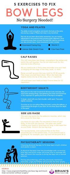 exercises to fix bow Knees Exercises, Knock Knees Exercises, Knock Knees Correction, Legs Training, Bow Legged Correction, Body Weight Squat, Cow Face Pose, Knock Knees, Bow Legged