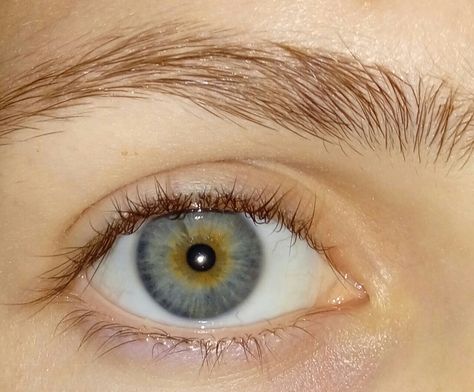 Central Hetrochormia Eyes, Blue Heterochromia Eyes, Central Heterochromia Eyes Green Blue, Blue Eyes Heterochromia, Central Heterochromia Eyes, Heterochromia Eyes Aesthetic, Central Heterochromia, Heterochromia Eyes, Blue Eyes Aesthetic