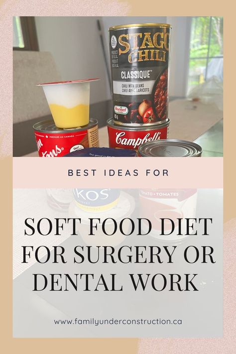 Soft Food Diet After Dental Implants, Soft Foods For After Dental Surgery, Delicious Soft Food Recipes, Soft Foods After Dental Implant Surgery, Soft Meats After Surgery, Soft Food After Surgery, Soup After Dental Surgery, Soft Food Ideas After Dental Work, Soft Foods After Surgery Teeth Dentures