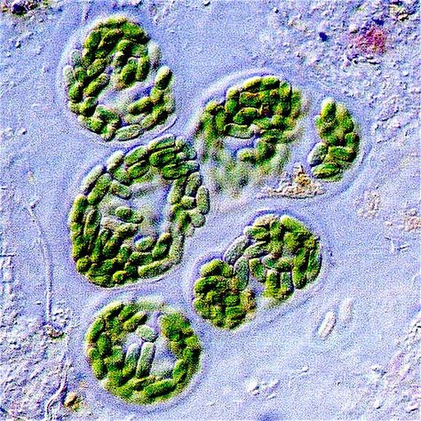 Unicellular bacteria from a microbial mat in Guerrero Negro, Baja California, Mexico. Light microscope view. (see also http://microbes.arc.nasa.gov/gallery/lightms.html) by NASA / Public domain Bacteria Under Microscope, Light Microscope, Under Microscope, Nitrogen Fixation, History Of Earth, Scanning Electron Micrograph, Microscopic Photography, Dna Replication, Plant Diseases