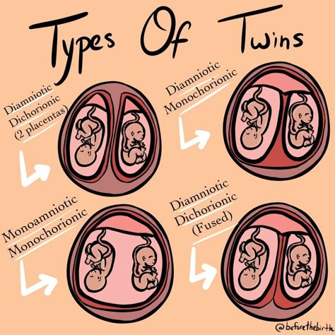 Types Of Twins, Midwifery Student, Diagnostic Medical Sonography, Ultrasound Technician, Student Midwife, Amniotic Fluid, Nursing School Motivation, Basic Anatomy And Physiology, Nurse Study Notes