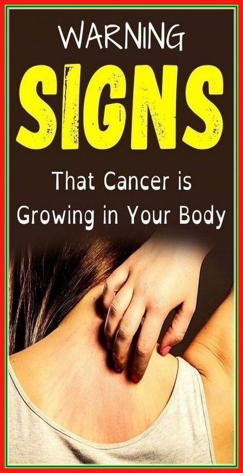 Abnormal Cells, Health Signs, Medical Help, Healthy Beauty, Health Facts, Warning Signs, Womens Health, Health Tips, Click Here