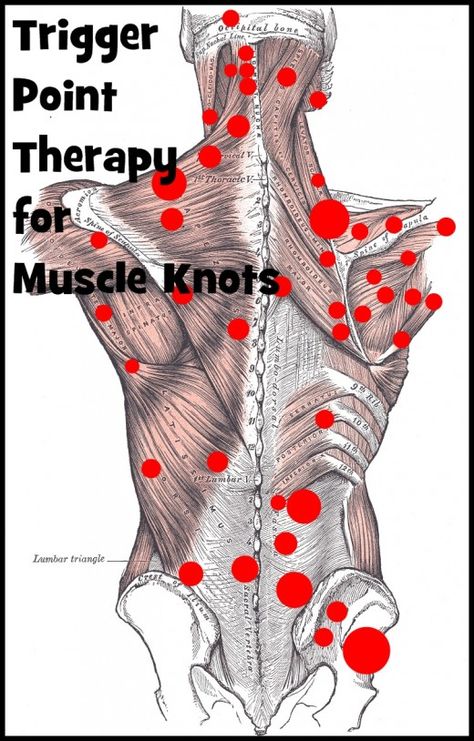 Punkty Spustowe, Muscle Knots, Massage Therapy Techniques, Trigger Point Therapy, Reflexology Massage, Trigger Point, Sports Massage, Trigger Points, Massage Techniques