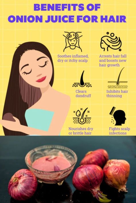 Onion juice for hair Onion Hair Mask For Hair Growth, Onion For Hair Growth How To Use, Onion Juice For Hair Growth, Juice For Hair Growth, Onion Hair Mask, Hair Growth Per Month, Juice For Hair, Onion Benefits, Onion Hair Growth