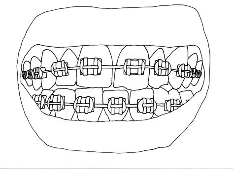 Braces Line Drawing by Sarah Norman Braces Mouth Drawing, Teeth With Braces Drawing, How To Draw Braces On Teeth, Smile With Braces Drawing, Dentistry Drawing, Braces Tattoo, How To Draw Braces, Drawing Braces, Braces Drawing