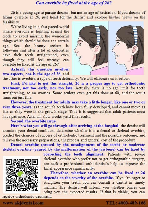 Can overbite be fixed at the age of 26? Actually this question involves two aspects, one is the age of 26, and the other is overbite, a type of teeth deformity. We will elaborate on it below. Fix Overbite, Orthognathic Surgery, Teeth Alignment, Facial Bones, Facial Nerve, Orthodontics Braces, Teeth Straightening, Beauty Smile, The Dentist