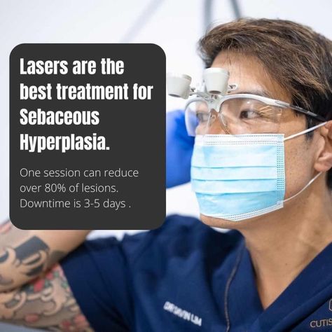 sebaceous hyperplasia Sebaceous Hyperplasia, Erbium Laser, Fractional Laser, Laser Resurfacing, Retinoic Acid, Skin Science, Genetic Disorders, Medication Management, Deep Wrinkles