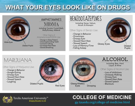 Drugged Eyes, Emt Study, Nurse Teaching, College Of Medicine, Droopy Eyes, Glossy Eyes, Medical School Essentials, How To Read People, Medicine Doctor